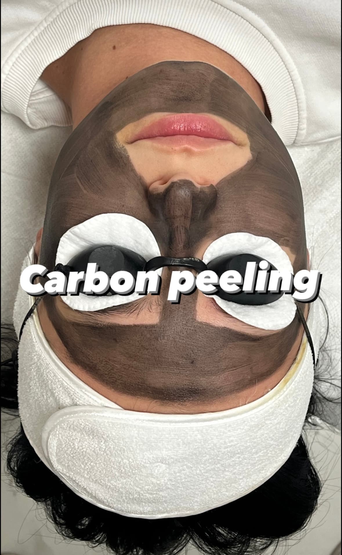 Carbon peeling