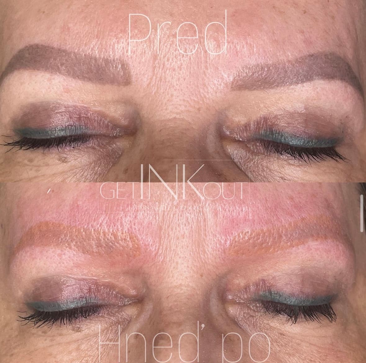 Odstránenie starého PMU